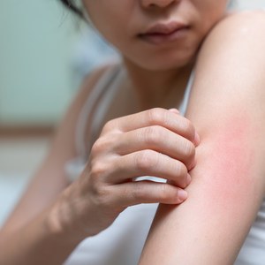 Natural Skincare for Sensitive Skin: How to Soothe and Heal Naturally